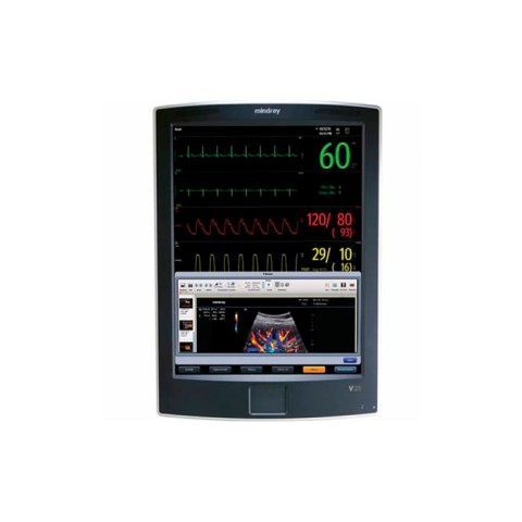 Монитор пациента Mindray V21 - 0 руб.
