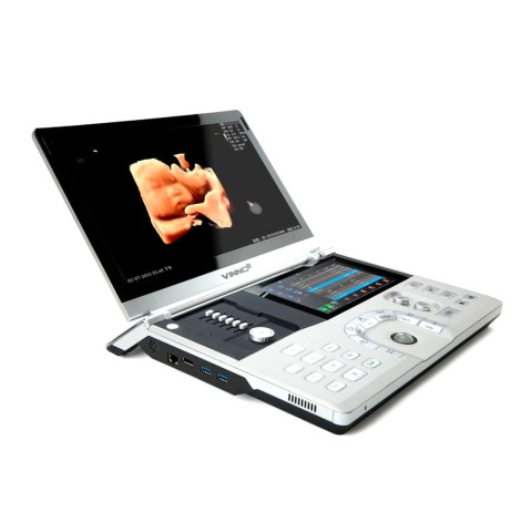 Портативный УЗИ аппарат VINNO 8 - 745 745 руб.