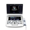 УЗИ аппарат Edan Acclarix AX3 - 701 508 руб.