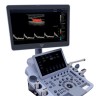 УЗИ аппарат Edan Acclarix LX9 - 2 244 825 руб.