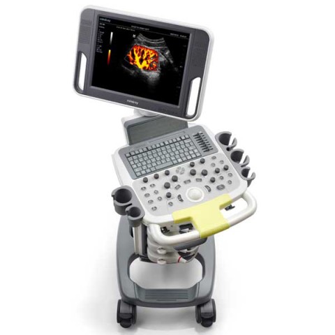 УЗИ сканер Mindray DC-N3 - 310 800 руб.