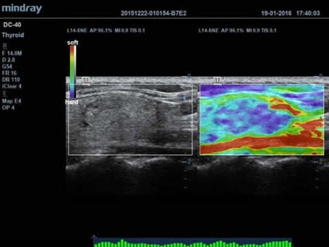 Аппарат ультразвуковой диагностический DC-40 - 380 900 руб.
