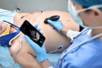 УЗИ сканер Mindray TE Air i3P - 336 000 руб.
