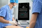 УЗИ сканер Mindray TE Air i3P - 336 000 руб.