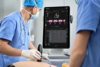 УЗИ сканер Mindray TE Air i3P - 336 000 руб.