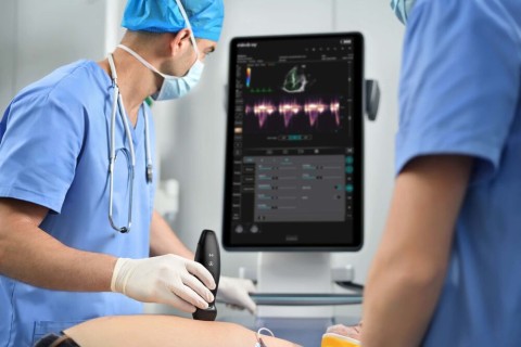 УЗИ сканер Mindray TE Air i3P - 329 800 руб.