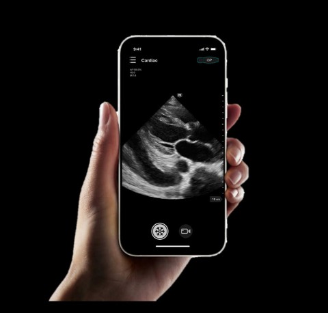 УЗИ сканер Mindray TE Air i3P - 329 800 руб.